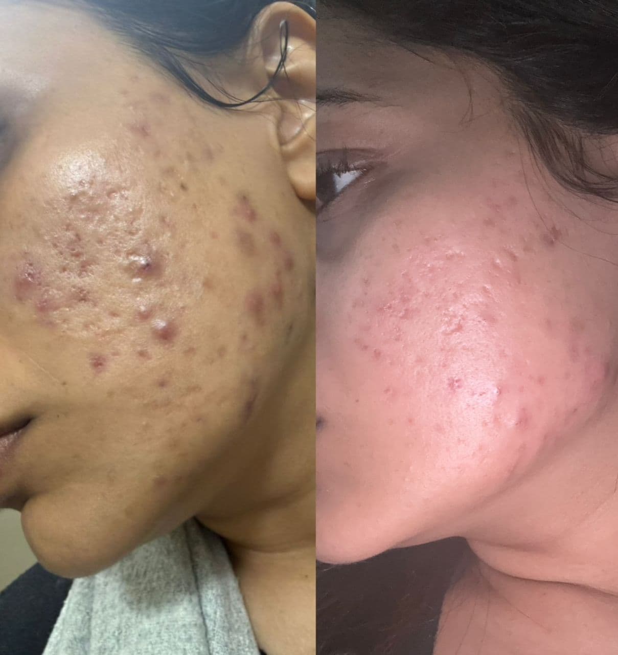 Before and After result 4